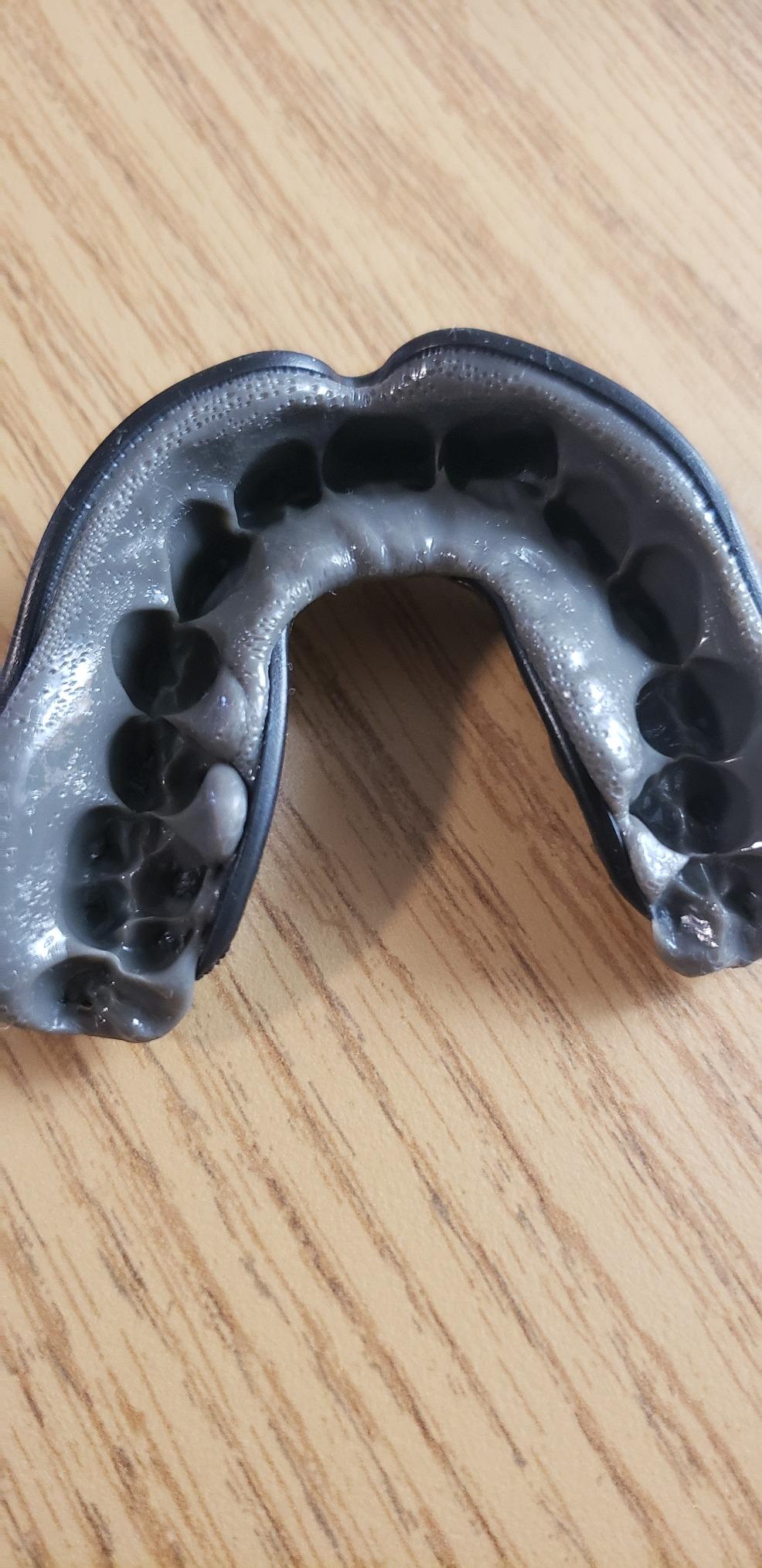 Venum Challenger Mouthguard - Black/Ice customer photo 1