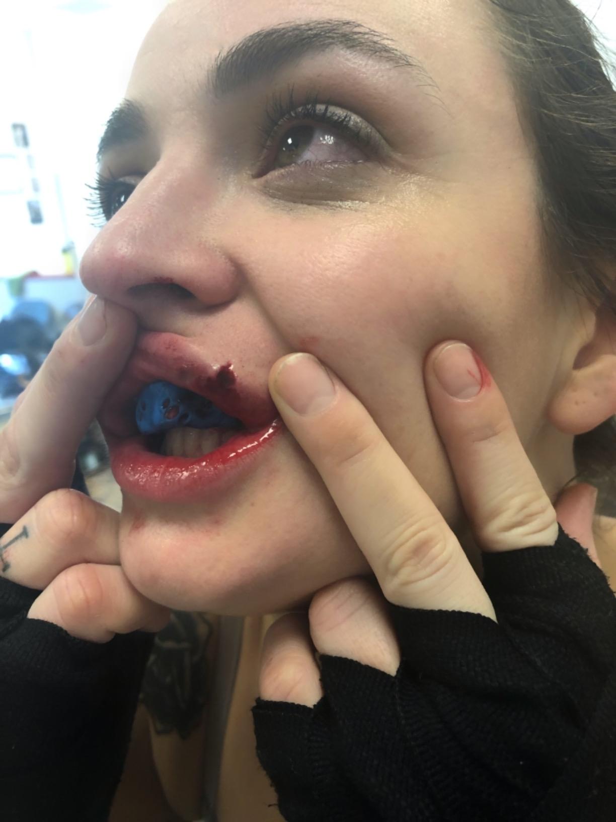 SISU Max Mouthguard - 50% Stronger, Maximum Protection for Rugby, MMA, Boxing, Lacrosse, Football, Hockey, High-Impact Sports - Adult Fit, Remoldable Up to 20 Times, Works for Braces customer photo 1