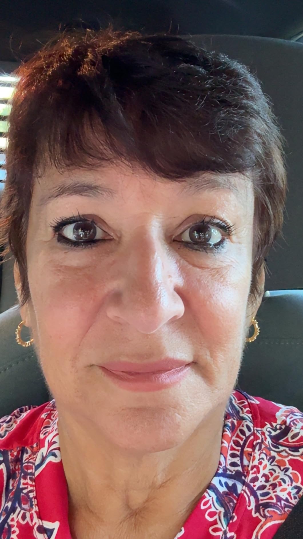 RoC Retinol Correxion Deep Wrinkle Retinol Face Serum, Ascorbic Acid, 1 0z customer photo 1