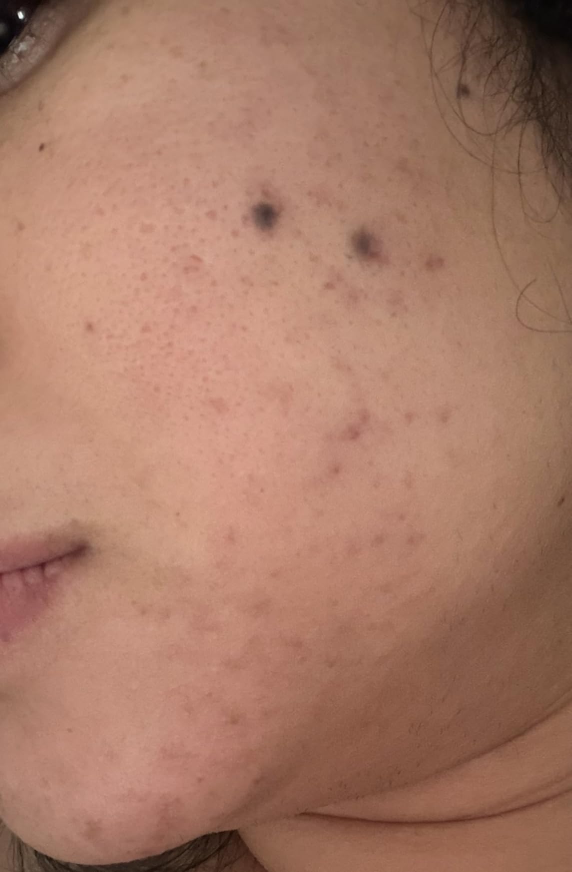 CeraVe Resurfacing Retinol Face Serum with Niacinamide, Pore Minimizer, 1oz | Skin Care Brightening Serum with Licorice Root, Acne Scar & Hyperpigmentation Treatment, Dark Spot Corrector, Skin Repair customer photo 1
