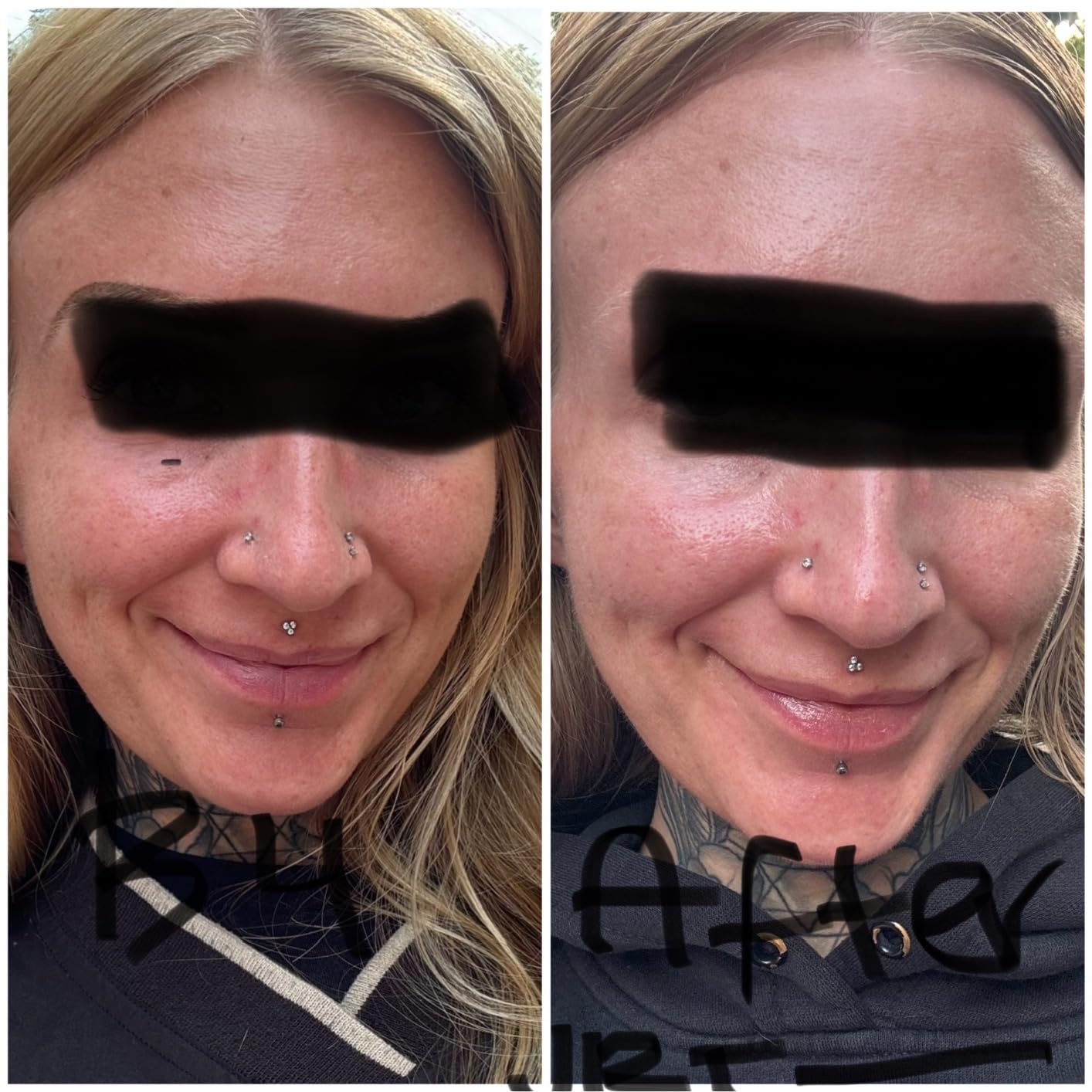 Premium 20% Vitamin C Serum For Face with Hyaluronic Acid, Retinol & Amino Acids - Boost Skin Collagen,Hydrate & Plump Skin, Anti Aging & Wrinkle Facial Serum 60ml customer photo 2