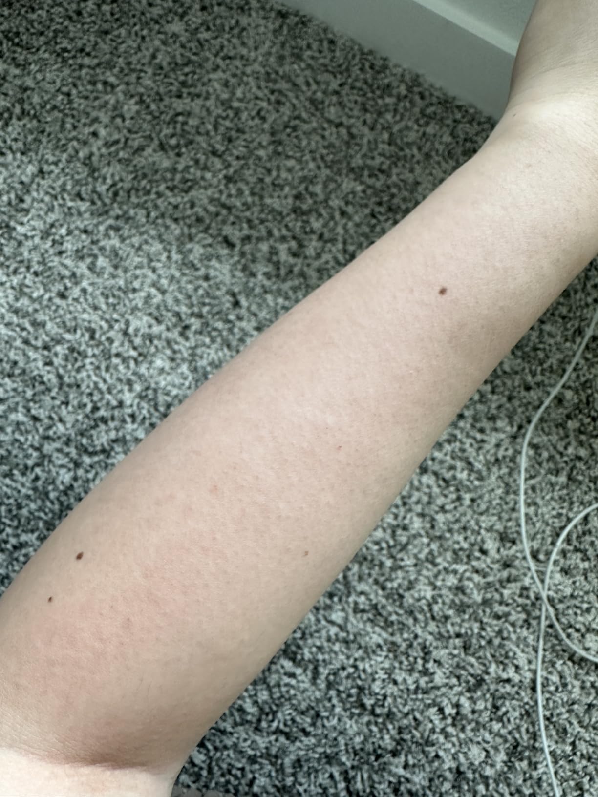 Ulike Laser Hair Removal Device Air 10 Ipl Gift for Women and Men, Ice Cool and Permanent Hair Reduction for Nearly Painless, Dual Lights, Skin Sensor & USHR Mode Hair Removal in 10mins from Home customer photo 2