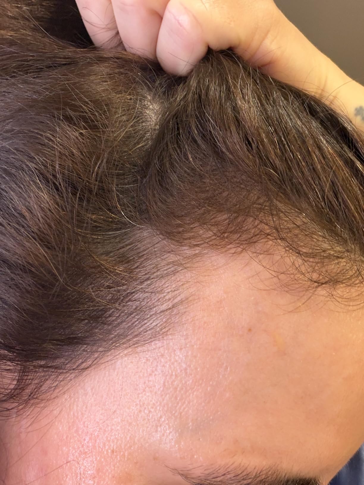 Nutrafol Women's Hair Serum, Supports Visibly Thicker and Stronger Hair, Vegan, Lightweight and Fast-Absorbing. customer photo 1