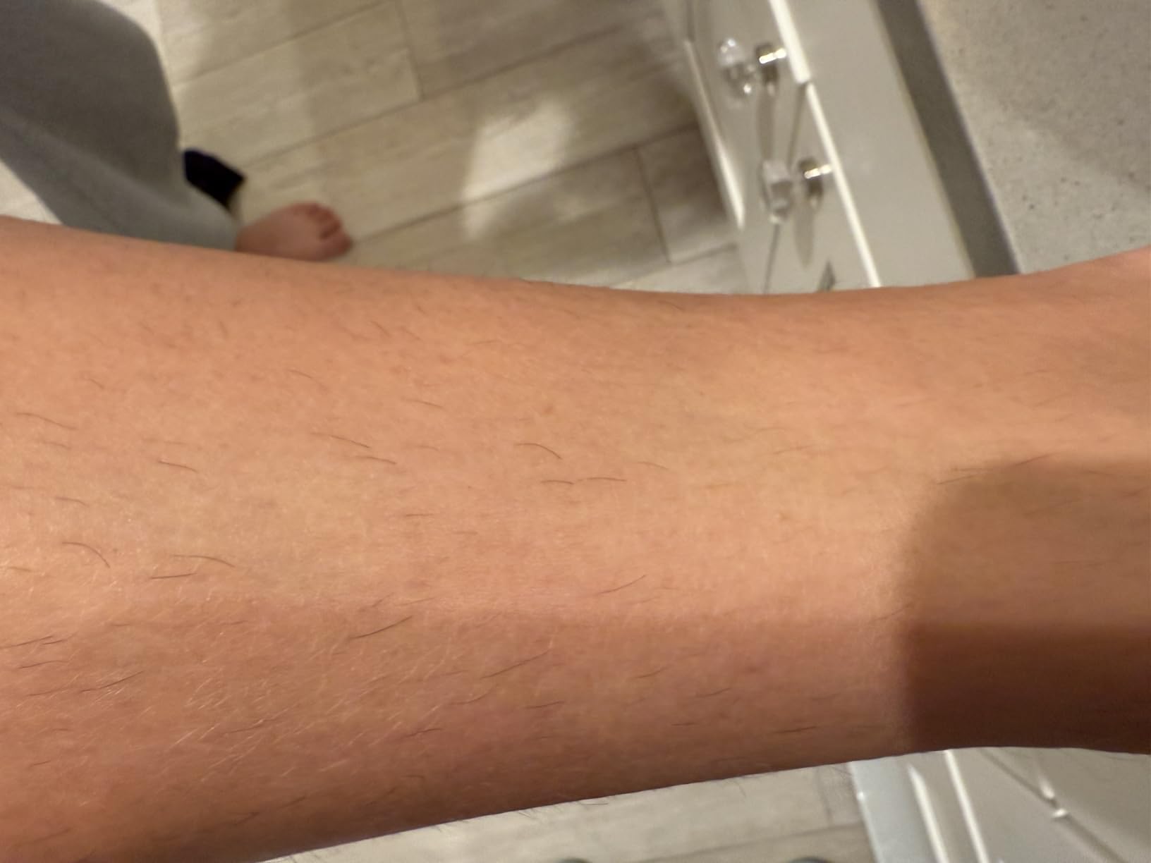 Finequin Laser Hair Removal for Women & Men, 45°F Ice-Cooling Contact, Safe & Virtually Painless Alternative to Salon IPL Hair Removal Device, Long-Lasting Hair Removal from Home, with Razor & Glasses customer photo 2