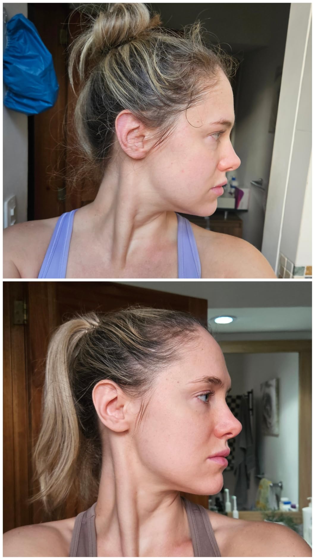 INIA FLARE 3-in-1 Red Light Therapy Beauty Device for Face & Neck Pink customer photo 2