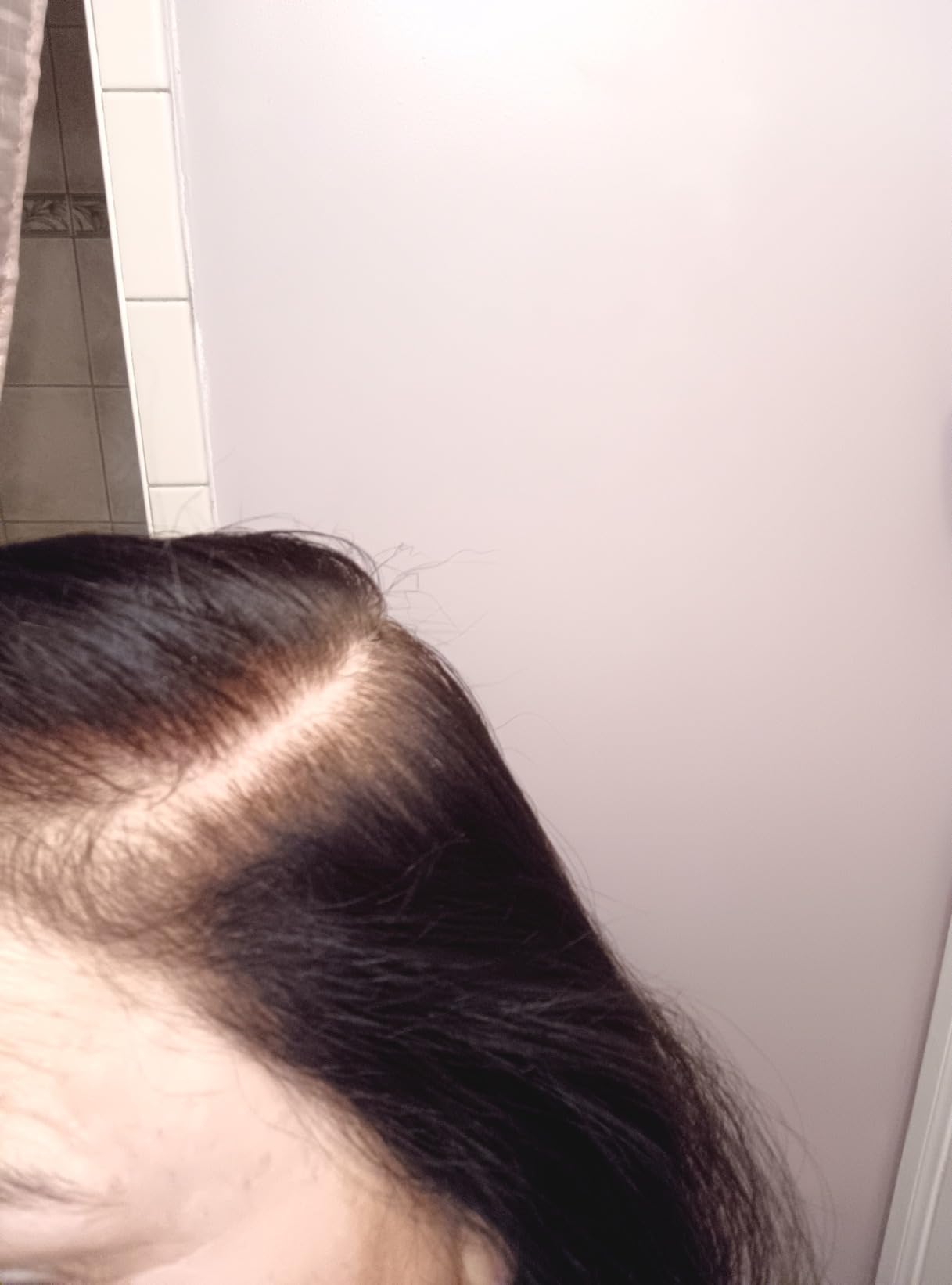 Hair Growth Serum Scalp Treatment: Scalp Serum with Rosemary, Multi-Peptide & Caffeine for Anti Hair Loss and Thinning - Thickening and Density for Women & Men customer photo 1